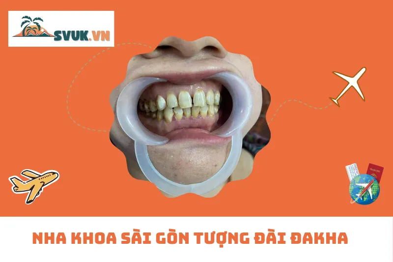 Nha Khoa Sài Gòn Tượng Đài Đakha