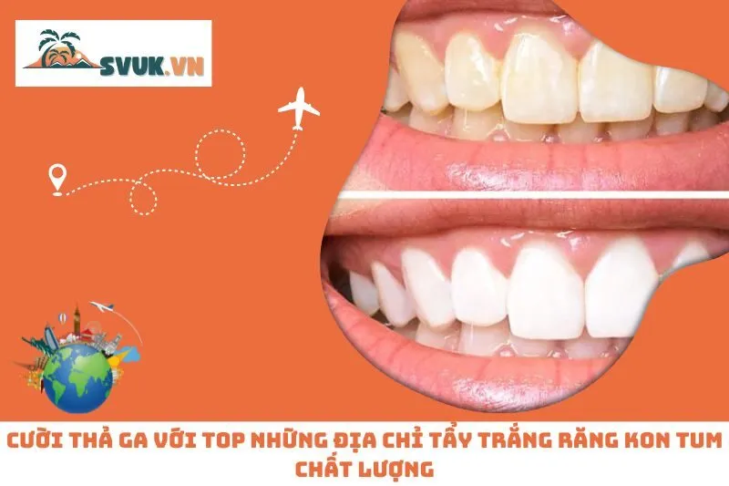 Cười Thả Ga Với Top Những Địa Chỉ Tẩy Trắng Răng Kon Tum Chất Lượng