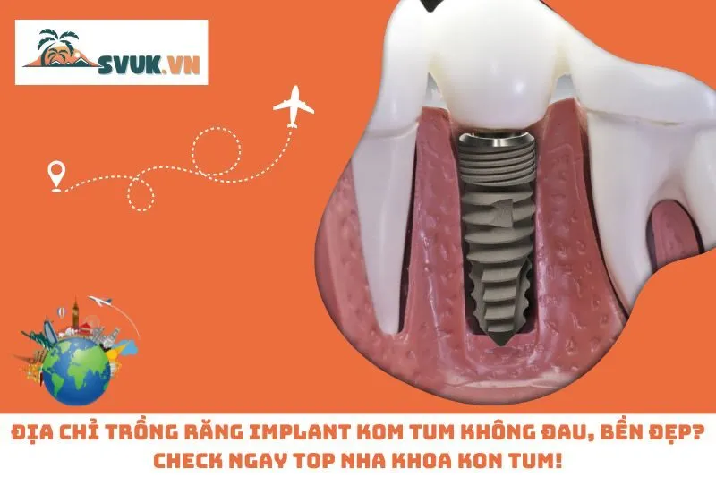 Địa Chỉ Trồng Răng Implant Kom Tum Không Đau, Bền Đẹp? Check Ngay Top Nha Khoa Kon Tum!